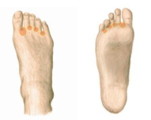Kshipra Marma des orteils - crampes du pieds ou du mollet